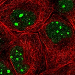 TFIIIC Antibody, Novus Biologicals 0.1mL; Unlabeled:Antibodies, Polyclonal